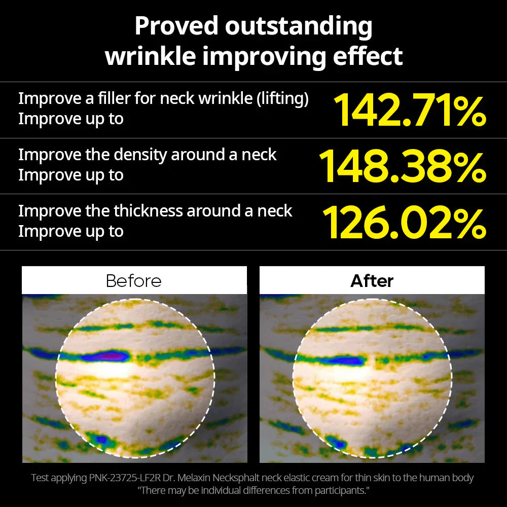Necksphalt ECM Neck Barrier Cream