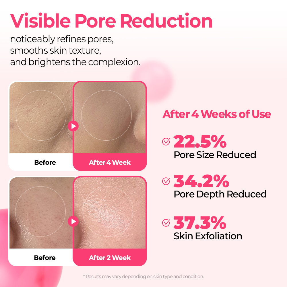 Cemenrete Cyano Pink Spicule Serum